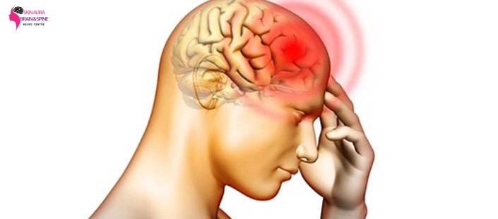 brain hemorrhage treatment in gurgaon