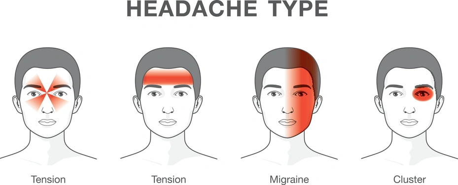 head pain doctors in gurgaon