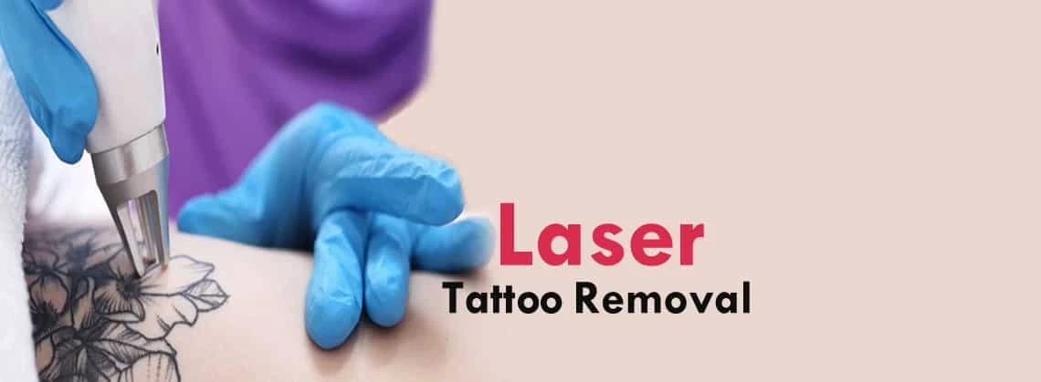 Best Laser Tattoo Removal Clinic in Gurgaon, India