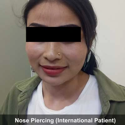 painless nose piercing in gurgaon