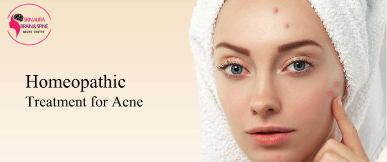 Homeopathic Treatment for Acne | Skin Clinic in Gurgaon