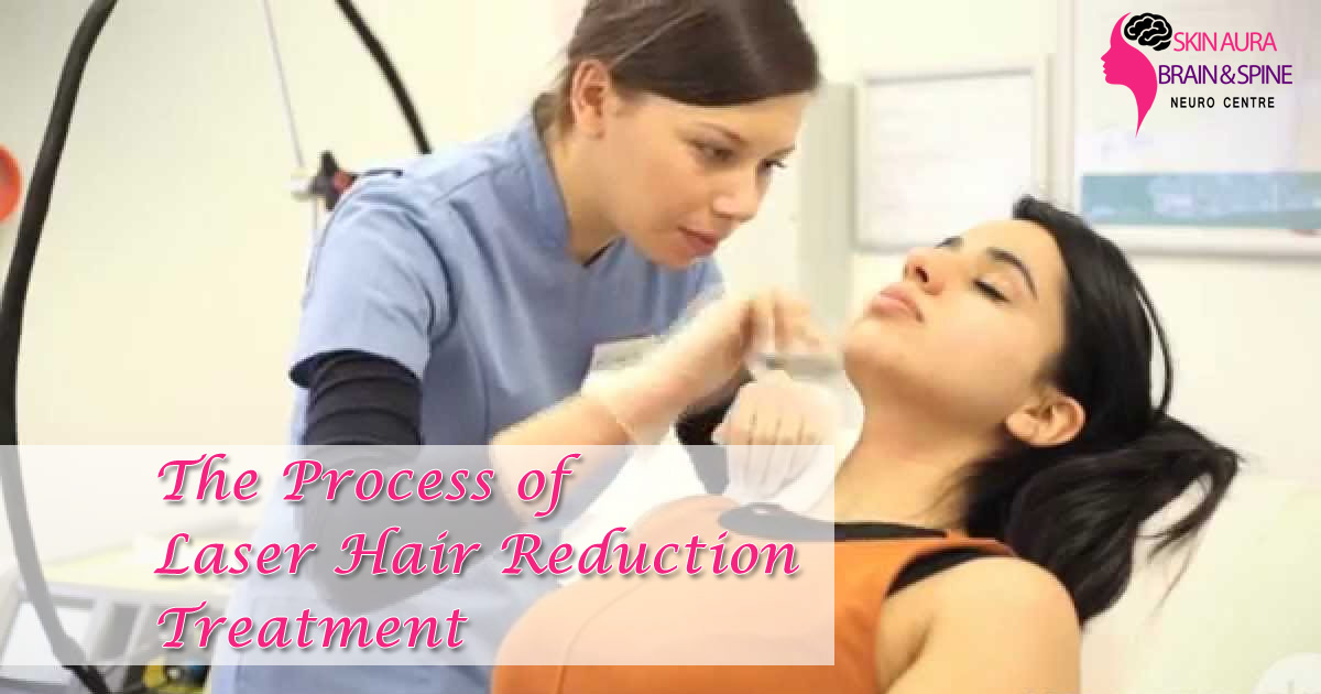 Process of Laser Hair Reduction