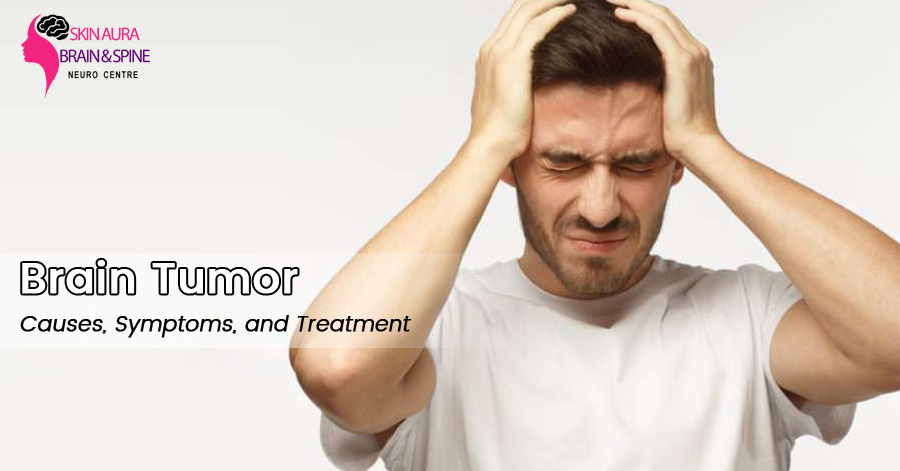 Brain Tumor – Causes, Symptoms, and Treatment