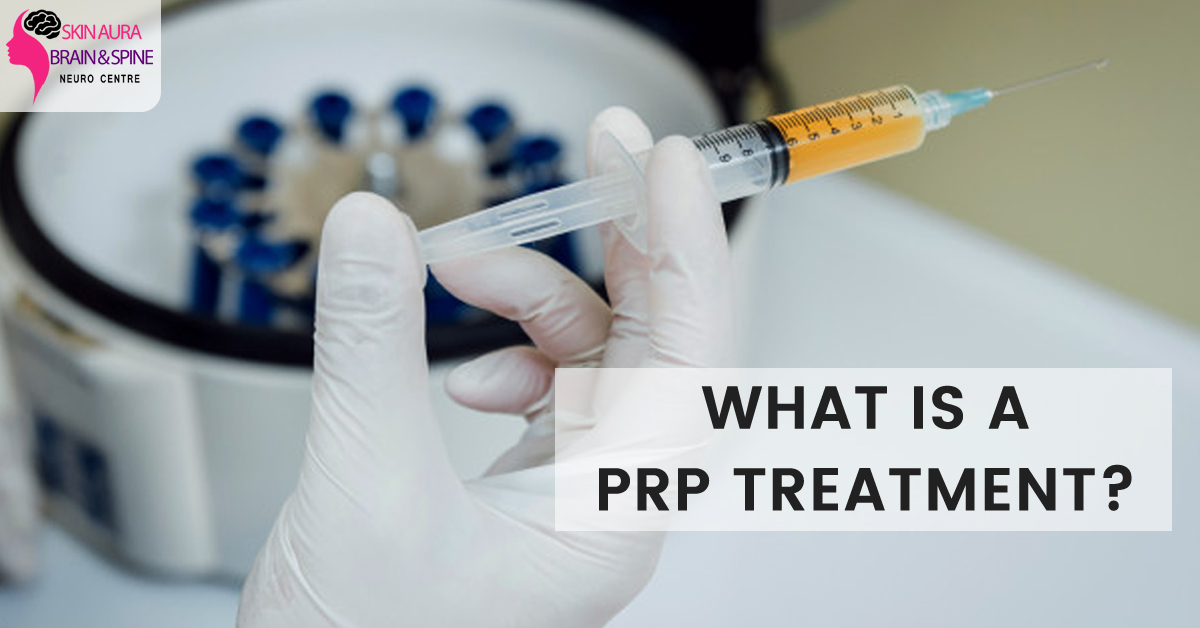 what is prp treatment