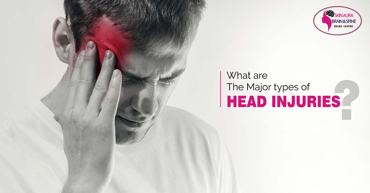 Major Types of Head Injuries
