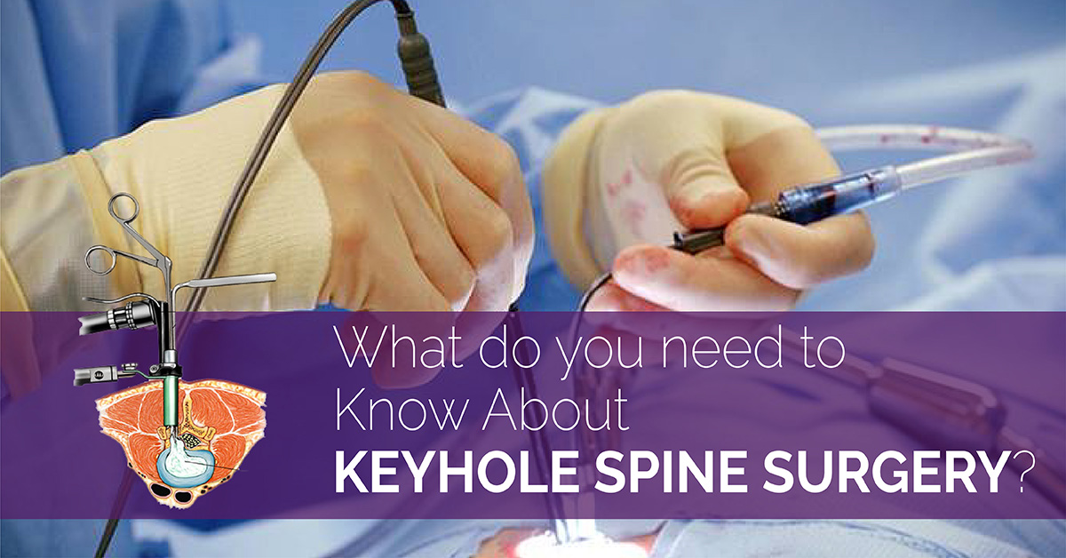 Keyhole Spine Surgery