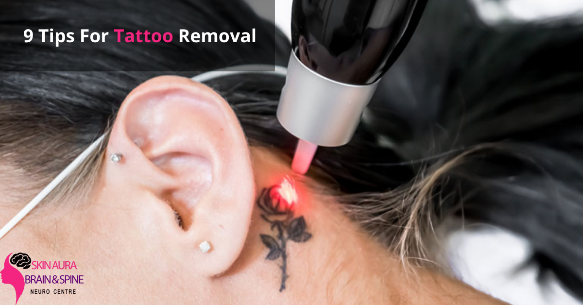 9 Tips For Tattoo Removal