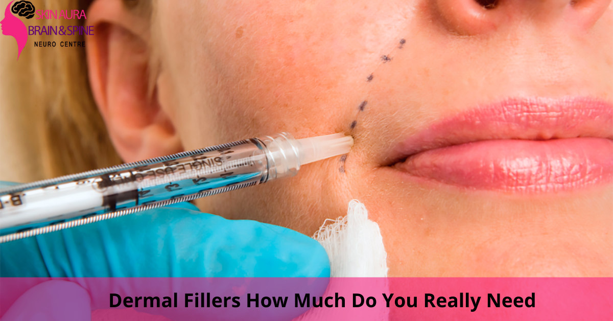 Dermal Fillers How Much Do You Really Need
