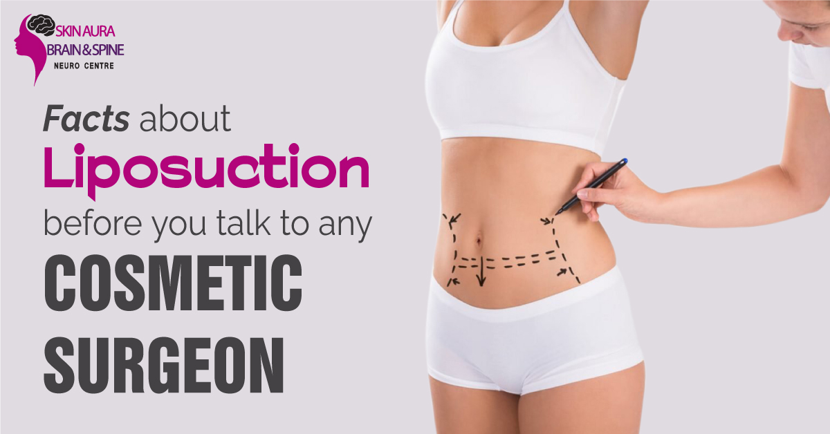 Liposuction Cosmetic Surgeon