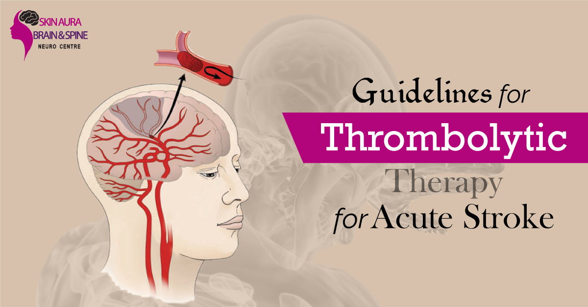 Thrombolysis for Acute Brain Stroke