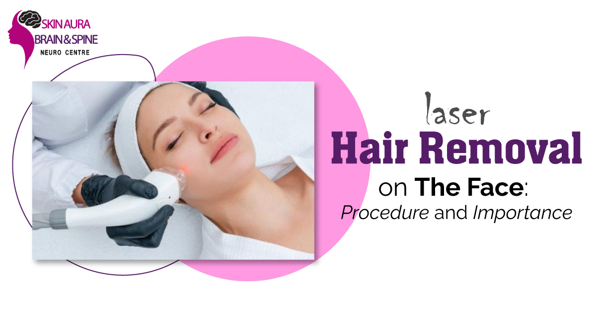 Laser Hair Removal Treatment in Delhi NCR