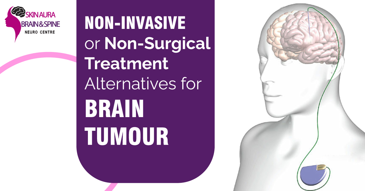 Brain Tumor Treatment in Gurgaon