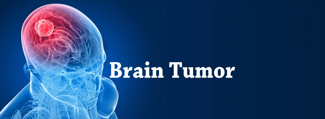 Brain Tumor Surgery Clinic in Gurgaon, India