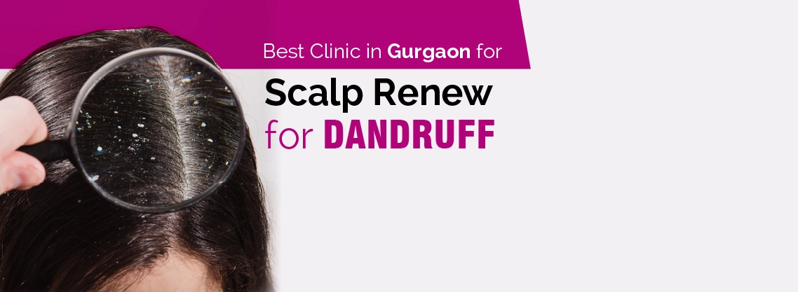 Scalp Renew For Dandruff in Gurgaon