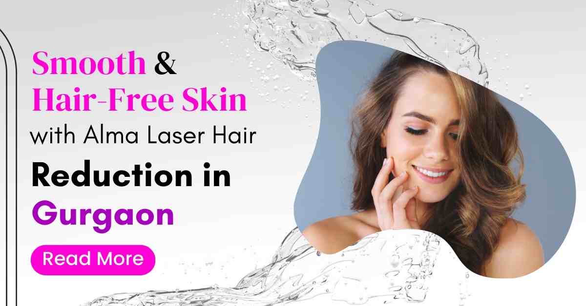 Read more about the article Smooth & Hair-Free Skin with Alma Laser Hair Reduction in Gurgaon