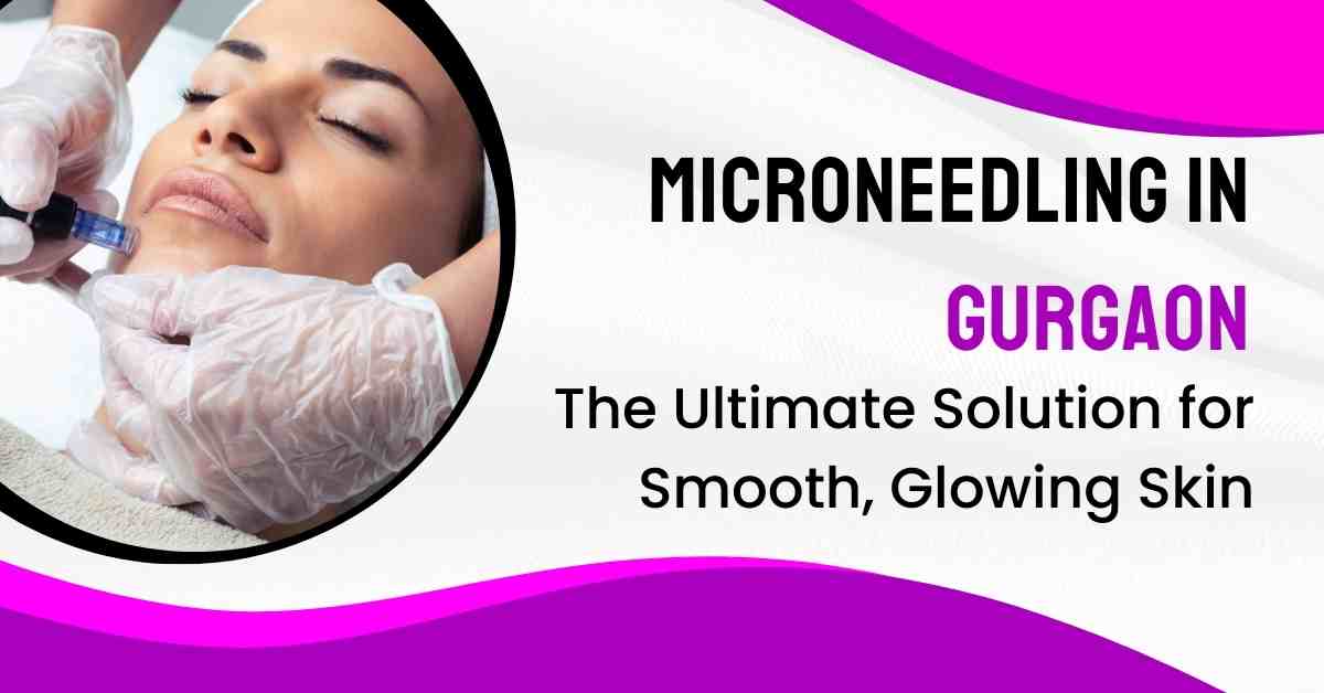 You are currently viewing Microneedling Treatment in Gurgaon