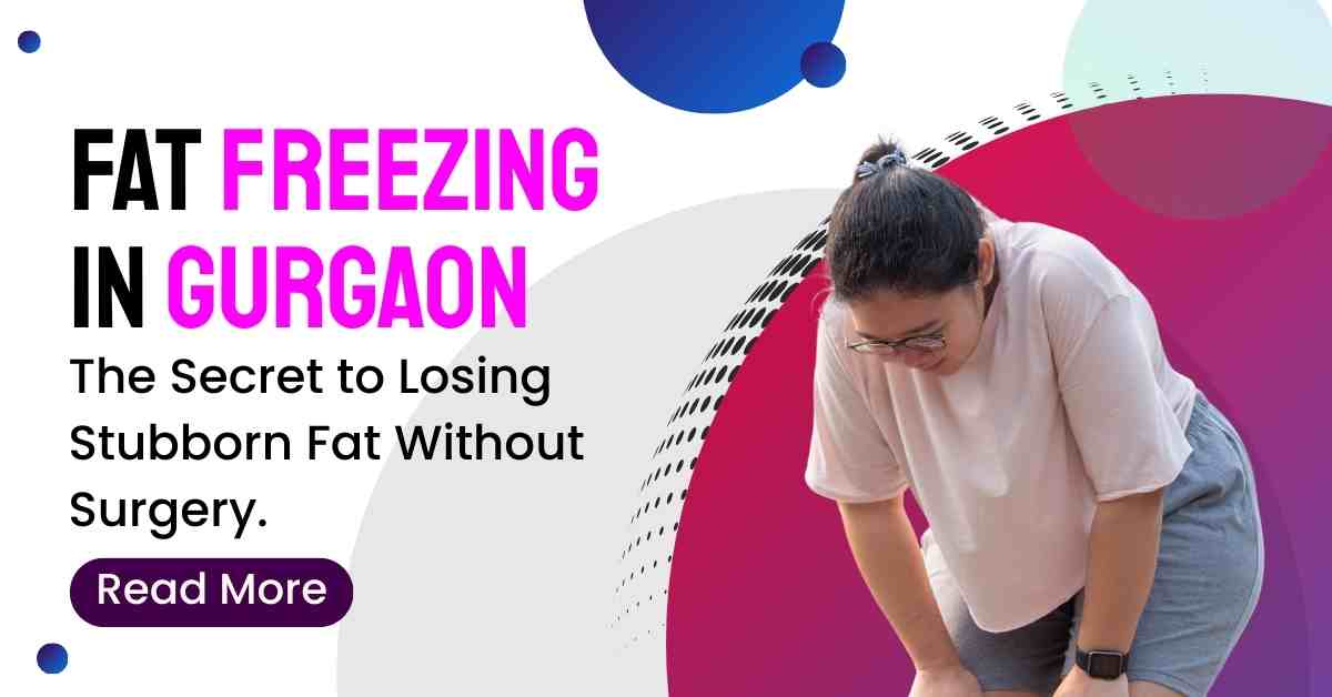 Read more about the article Fat Freezing in Gurgaon: The Secret to Losing Stubborn Fat Without Surgery