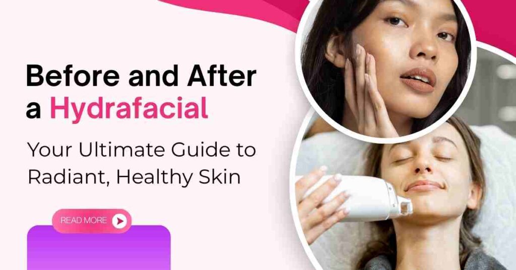 Before and After a Hydrafacial