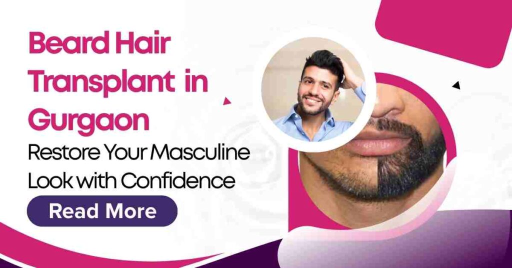 Beard Hair Transplant in Gurgaon