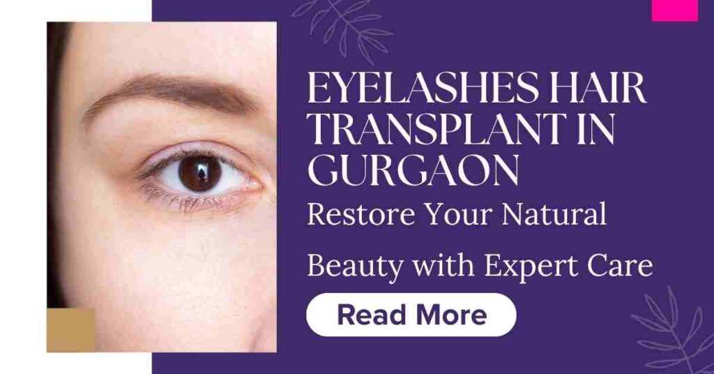 Eyelashes Hair Transplant in Gurgaon