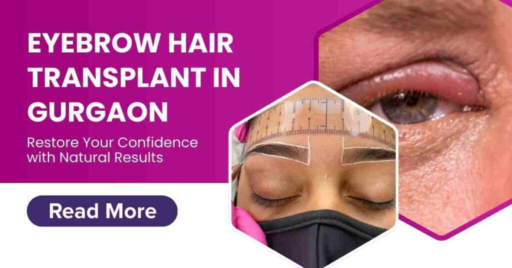 Eyebrow Hair Transplant in Gurgaon