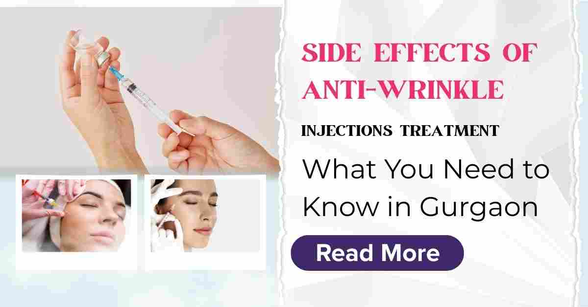 You are currently viewing Side Effects of Anti-Wrinkle Injections Treatment