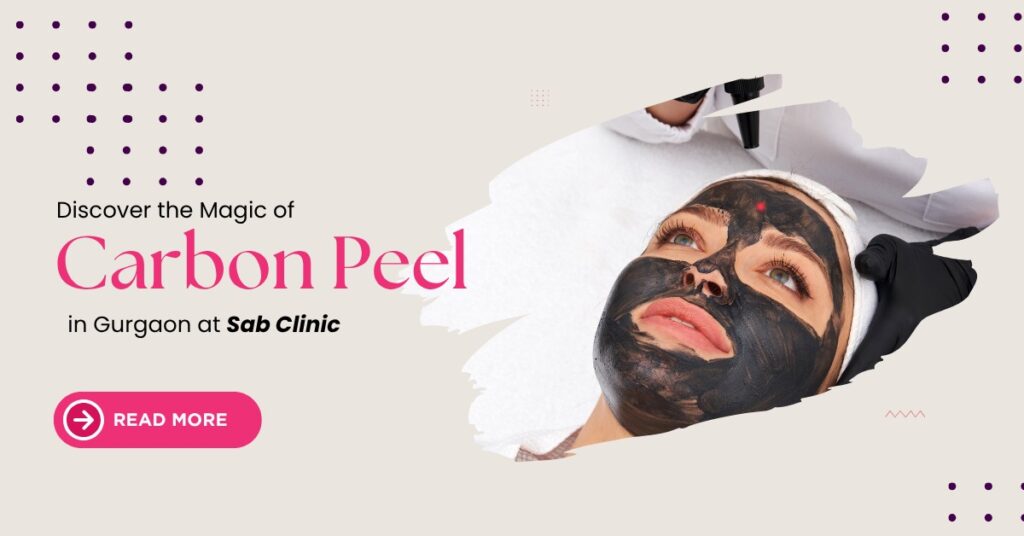 Carbon Peel in Gurgaon