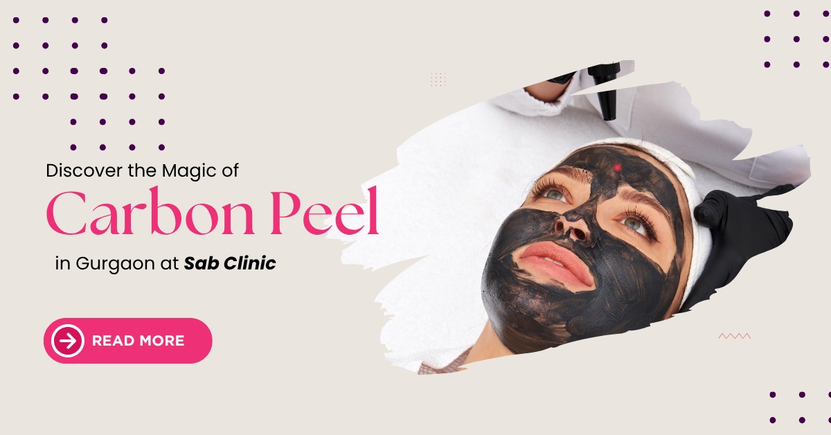 You are currently viewing Discover the Magic of Carbon Peel in Gurgaon at Sab Clinic