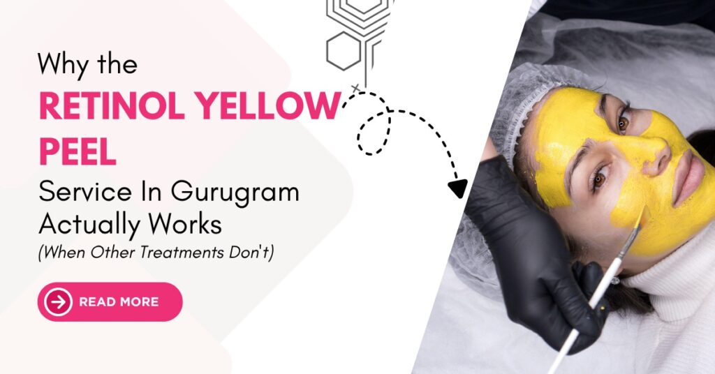 Retinol Yellow Peel Service In Gurugram