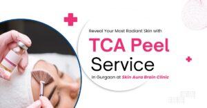 Read more about the article Reveal Your Most Radiant Skin with TCA Peel Service In Gurgaon at Skin Aura Brain Clinic