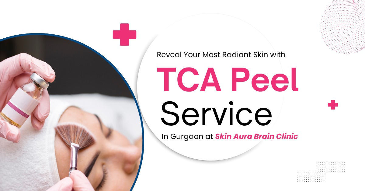 Read more about the article Reveal Your Most Radiant Skin with TCA Peel Service In Gurgaon at Skin Aura Brain Clinic