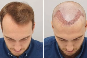 Skin Disease & Cosmetic Treatment