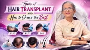 types of hair transplant