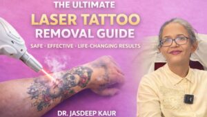 Laser Tattoo Removal