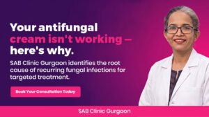 Dermatologist at SAB Clinic Gurgaon examining fungal skin infection on patient's arm during consultation