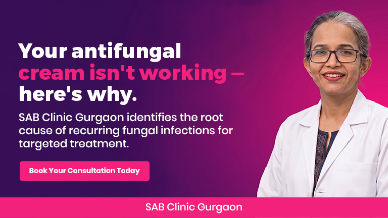 Dermatologist at SAB Clinic Gurgaon examining fungal skin infection on patient's arm during consultation