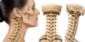 Cervical Spine Treatment in Gurgaon