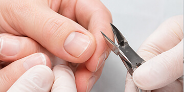 Nail Surgery Treatment in Gurgaon