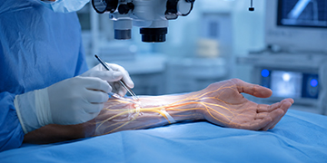 Peripheral Nerves Repair Treatment in Gurgaon