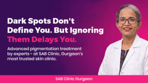 Pigmentation and dark spot treatment at SAB Clinic - trusted skin clinic in Gurgaon for melasma, tan removal, and uneven skin tone correction