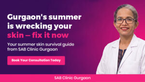 Dermatologist at SAB Clinic Gurgaon advising patient on summer skin care routine and sun protection