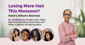 Woman checking hair fall on comb during monsoon season in Gurgaon