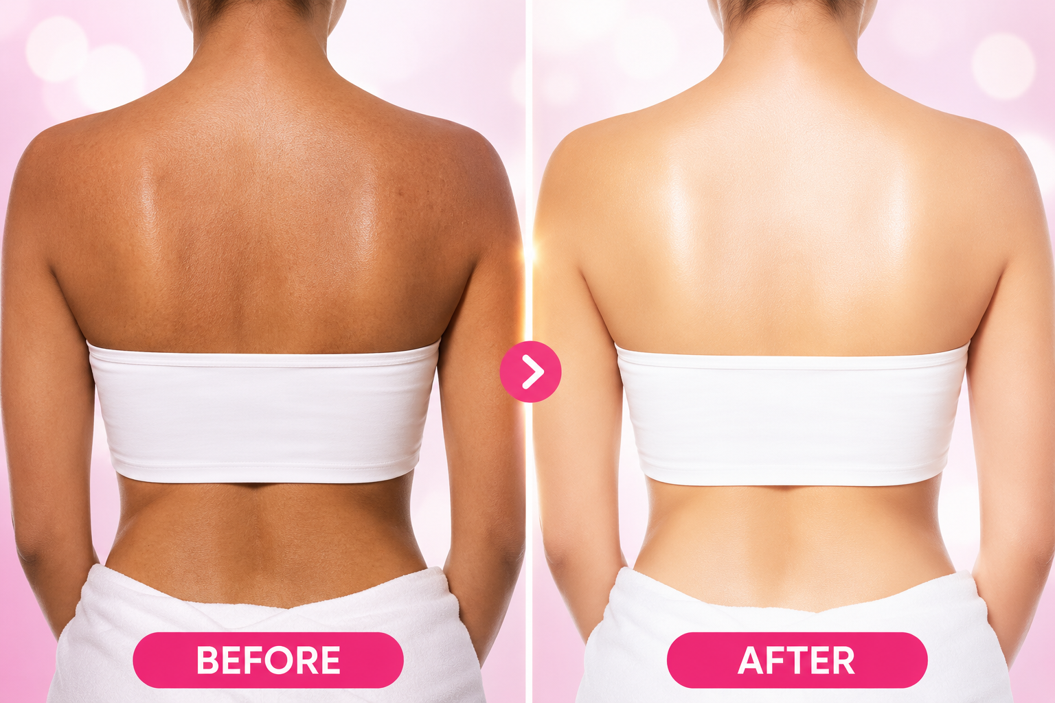 Before and after result of full body skin polishing treatment showing tan removal and brighter skin at Skin Aura Gurgaon