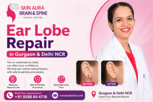 Ear Lobe Repair in Gurgaon & Delhi NCR
