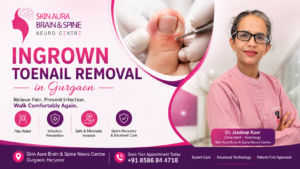 Ingrown Toenail Removal in Gurgaon