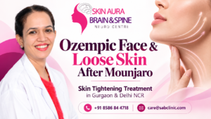Ozempic Face & Loose Skin After Mounjaro